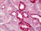 BCL2 / Bcl-2 Antibody (aa46-95)